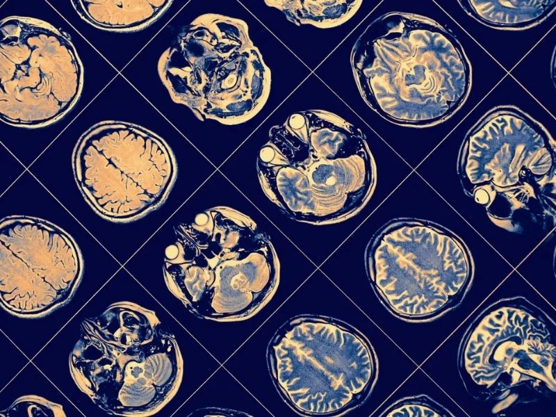 cocuklukta-davranis-degisiklikleri